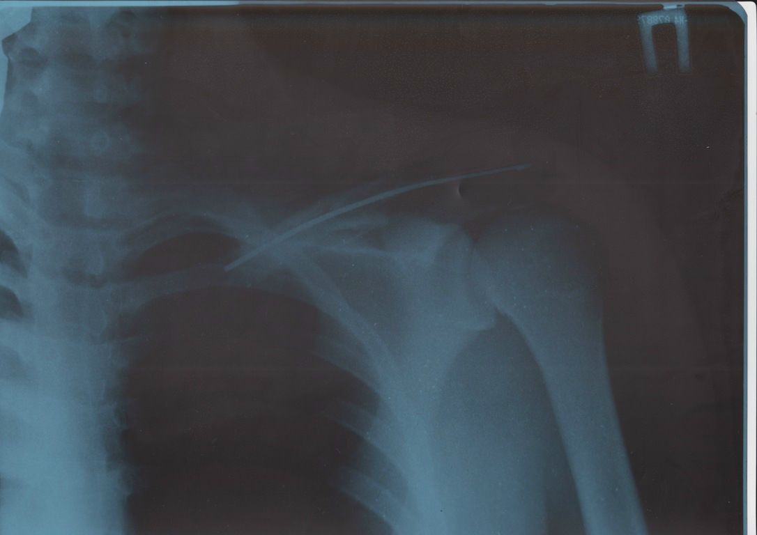 Иван Левков фотография #7