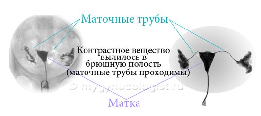 Когда Можно Заниматься Сексом После Гсг Когда Можно Заниматься Сексом После Гсг